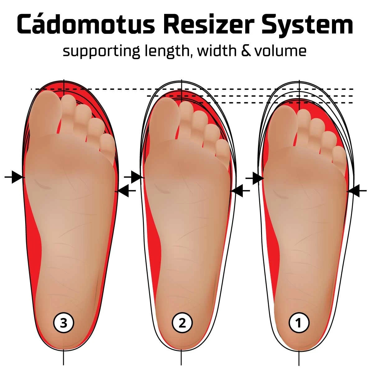 Cádomotus Resizer Insoles 4 Cádomotus Resizer Insoles - Image 4